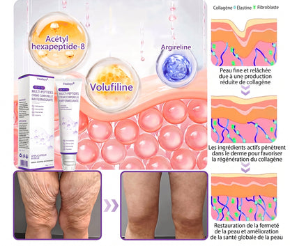👑Boutique officielle✅ : Vitalisys® PDRN Crème Corps avec Roller ✨ – Anti-âge, hydratation, fermeté et régénération. Pour un teint unifié, traite acné, taches pigmentaires et verrues 🥰