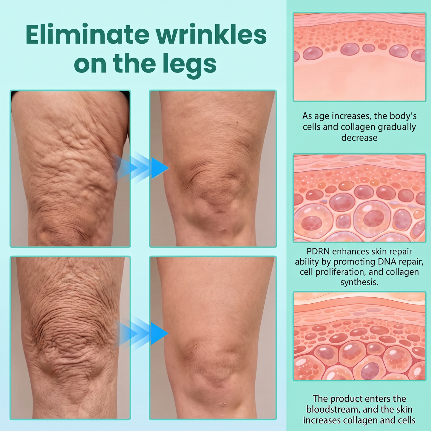 Vitalisys® PDRN Complex Peptide Capsule Cream|Anti aging, firming and lifting muscles Skin care, removal of stretch marks, breast enhancement, removal of chest lines, and skin repair❤️
