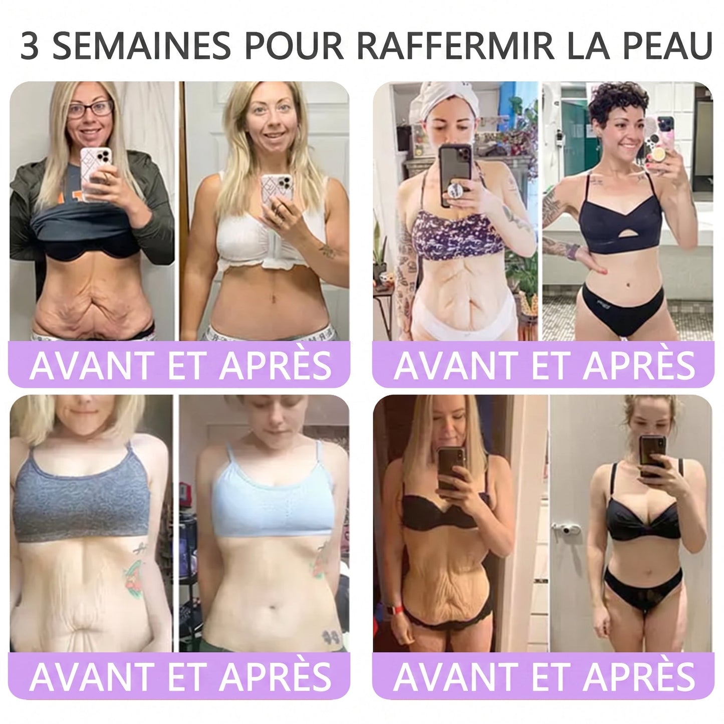 👑Boutique officielle✅ : Vitalisys® PDRN Crème Corps avec Roller ✨ – Anti-âge, hydratation, fermeté et régénération. Pour un teint unifié, traite acné, taches pigmentaires et verrues 🥰