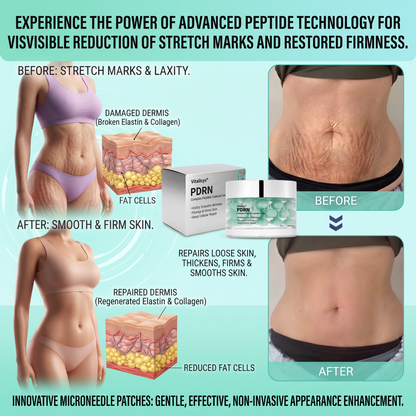Vitalisys® PDRN Complex Peptide Capsule Cream|Anti aging, firming and lifting muscles Skin care, removal of stretch marks, breast enhancement, removal of chest lines, and skin repair❤️