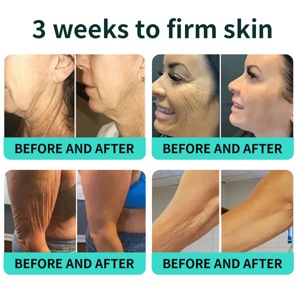 Vitalisys® PDRN Complex Peptide Capsule Cream|Anti aging, firming and lifting muscles Skin care, removal of stretch marks, breast enhancement, removal of chest lines, and skin repair❤️