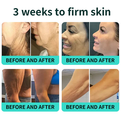Vitalisys® PDRN Complex Peptide Capsule Cream|Anti aging, firming and lifting muscles Skin care, removal of stretch marks, breast enhancement, removal of chest lines, and skin repair❤️