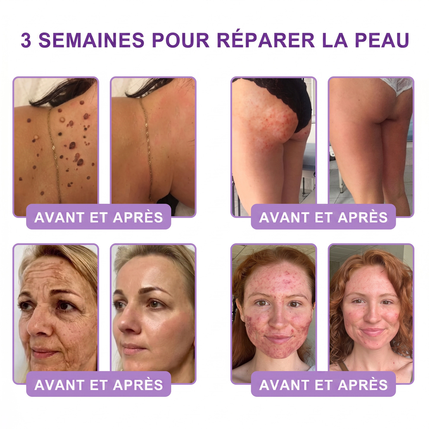 👑Boutique officielle✅ : Vitalisys® PDRN Crème Corps avec Roller ✨ – Anti-âge, hydratation, fermeté et régénération. Pour un teint unifié, traite acné, taches pigmentaires et verrues 🥰