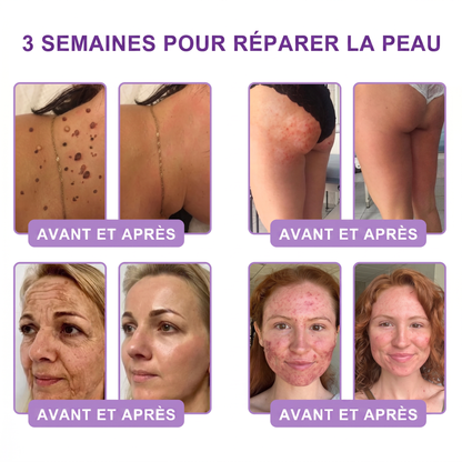 👑Boutique officielle✅ : Vitalisys® PDRN Crème Corps avec Roller ✨ – Anti-âge, hydratation, fermeté et régénération. Pour un teint unifié, traite acné, taches pigmentaires et verrues 🥰