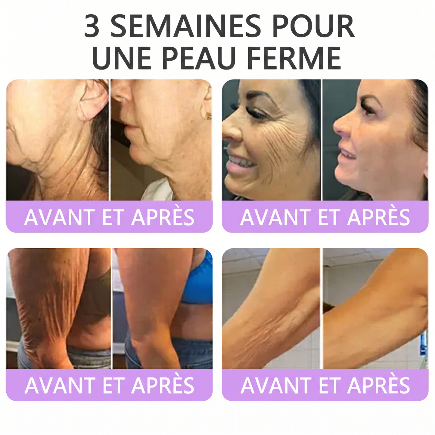 👑Boutique officielle✅ : Vitalisys® PDRN Crème Corps avec Roller ✨ – Anti-âge, hydratation, fermeté et régénération. Pour un teint unifié, traite acné, taches pigmentaires et verrues 🥰