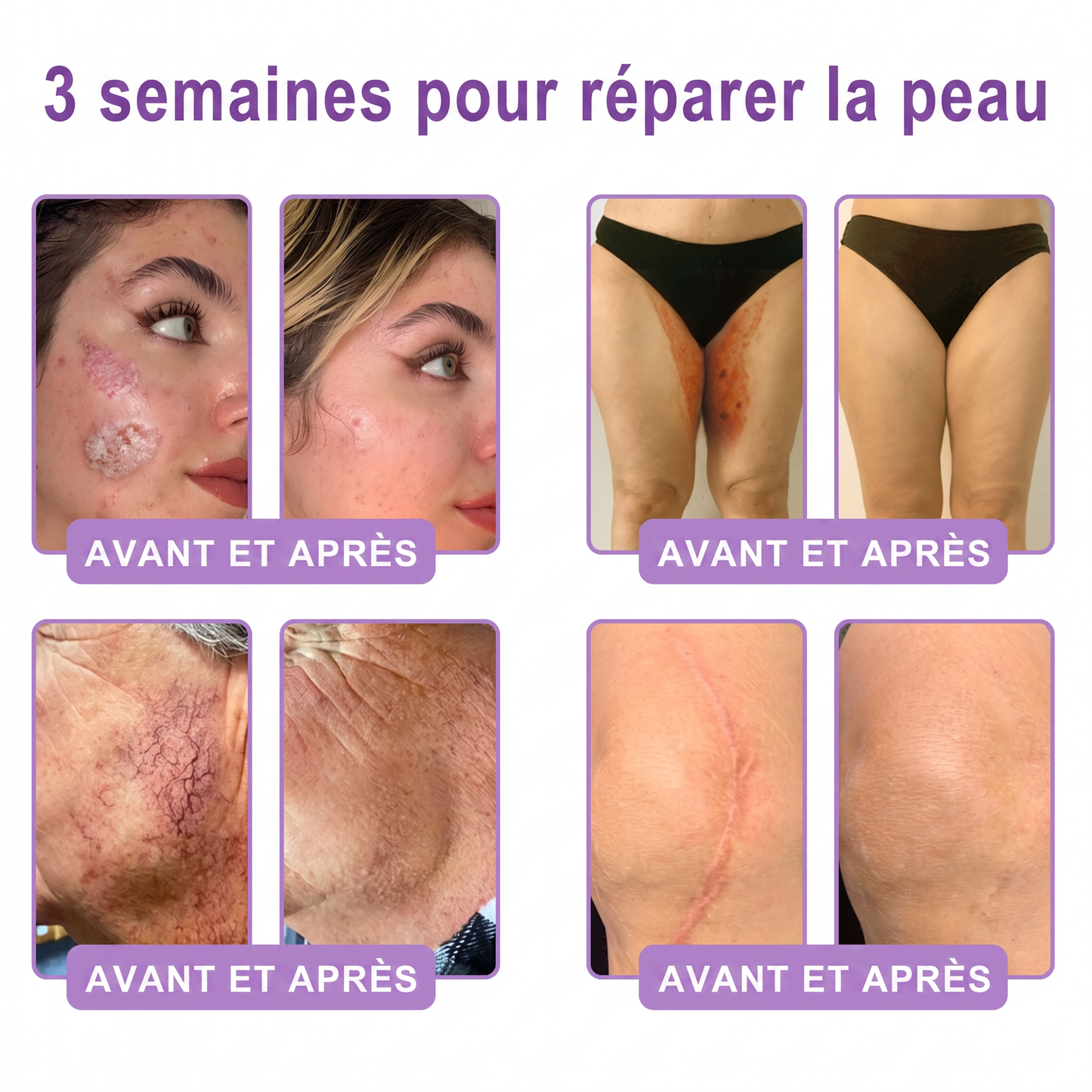 👑Boutique officielle✅ : Vitalisys® PDRN Crème Corps avec Roller ✨ – Anti-âge, hydratation, fermeté et régénération. Pour un teint unifié, traite acné, taches pigmentaires et verrues 🥰