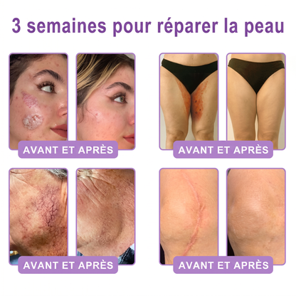 👑Boutique officielle✅ : Vitalisys® PDRN Crème Corps avec Roller ✨ – Anti-âge, hydratation, fermeté et régénération. Pour un teint unifié, traite acné, taches pigmentaires et verrues 🥰