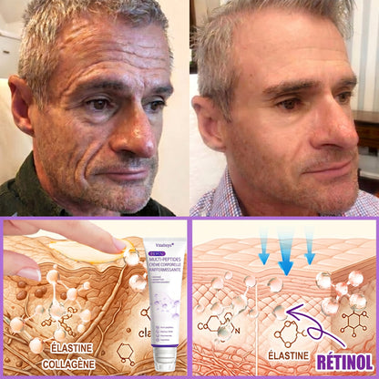 👑Boutique officielle✅ : Vitalisys® PDRN Crème Corps avec Roller ✨ – Anti-âge, hydratation, fermeté et régénération. Pour un teint unifié, traite acné, taches pigmentaires et verrues 🥰