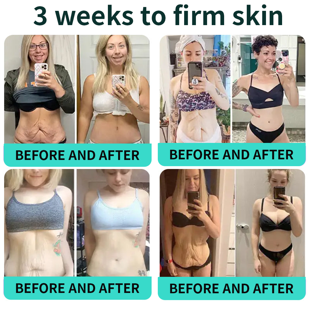 Vitalisys® PDRN Complex Peptide Capsule Cream|Anti aging, firming and lifting muscles Skin care, removal of stretch marks, breast enhancement, removal of chest lines, and skin repair❤️