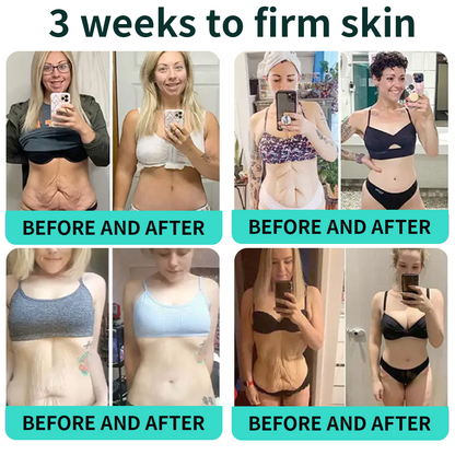 Vitalisys® PDRN Complex Peptide Capsule Cream|Anti aging, firming and lifting muscles Skin care, removal of stretch marks, breast enhancement, removal of chest lines, and skin repair❤️